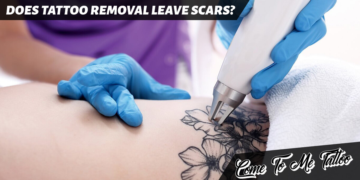 Does Tattoo Removal Leave Scars?